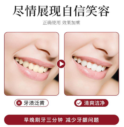 【全網火爆】牙齒美白首選——#買一贈二「益生菌口腔美白鯊魚牙膏」快美白!強健齒!淨口氣!科學檢測有效,洗掉大黃牙!