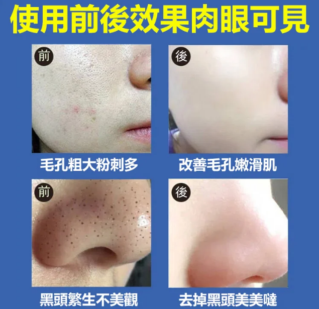 【官方正品 買二送一】醫用級美白潔面乳!告別黃黑皮!一洗就白!越洗越白!深層淡黑! 【官方正品 買二送一】醫用級美白潔面乳!告別黃黑皮!一洗就白!越洗越白!深層淡黑!